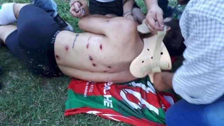 Απίστευτο περιστατικό! Η αστυνομία επιτέθηκε με πλαστικές σφαίρες σε ποδοσφαιριστές! (ΦΩΤΟ)