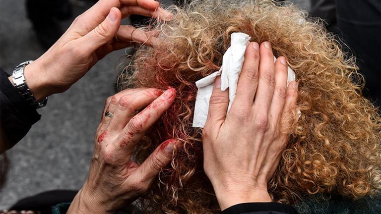 ΕΛ.ΑΣ: Κατεπείγουσα ΕΔΕ για τους τραυματισμούς στην πορεία των εκπαιδευτικών -  Γεροβασίλη: ΜΑΤ χτύπησαν στα τυφλά διαδηλωτές (ΦΩΤΟ)