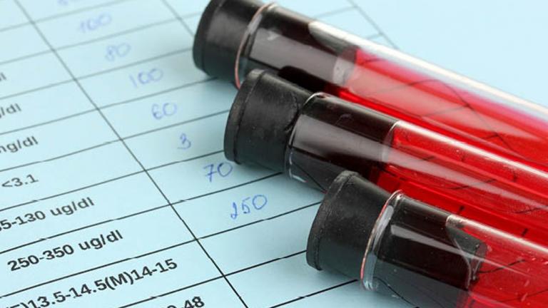 Ένα νέο τεστ που ανιχνεύει τον κρυμμένο ιό HIV καλύτερα και φθηνότερα!