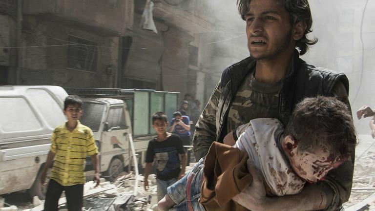 Χαλέπι: Παιδάκι χειρουργείται χωρίς αναισθησία