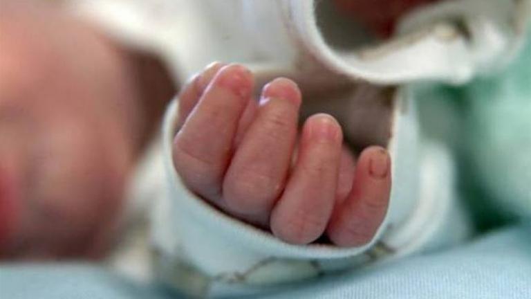 Μωρό στη Συρία γεννήθηκε με δύο κεφάλια (ΦΩΤΟ)