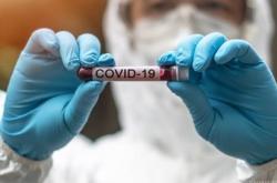 Γαλλία: Η παραλλαγή Ομικρον «ίσως είναι η αρχή της εξέλιξης προς έναν πιο κοινό ιό»