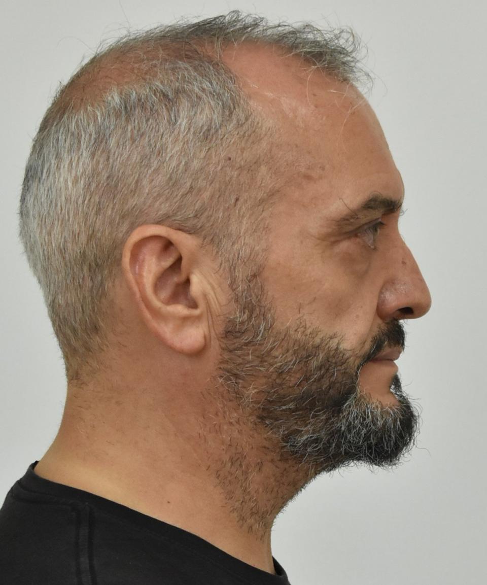 Πρόκειται για τον Μίχο Ηλία του Παναγιώτη και της Γιασεμής, γεννηθέντα την 30-12-1969 στο Αγρίνιο