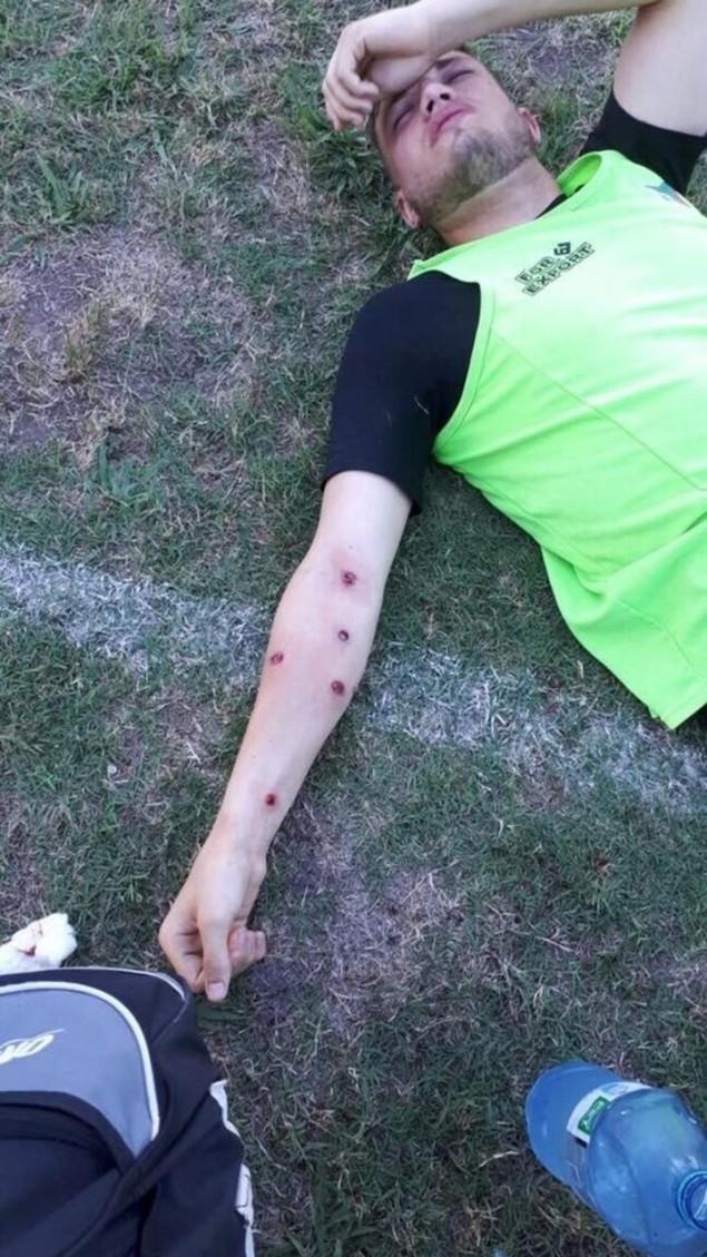 ΑΣΤΥΝΟΜΙΚΟΙ ΓΑΖΩΣΑΝ ΜΕ ΠΛΑΣΤΙΚΕΣ ΣΦΑΙΡΕΣ ΠΟΔΟΣΦΑΙΡΙΣΤΕΣ