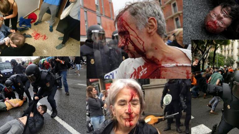 Δημοψήφισμα Καταλονία: Εικόνες ωμής βίας - Αίμα στους δρόμους της Καταλονίας (ΦΩΤΟ+ΒΙΝΤΕΟ)