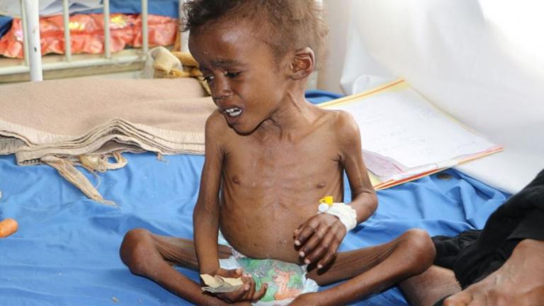 Υεμένη: Φόβοι για χιλιάδες νεκρούς καθημερινά εξαιτίας του λιμού