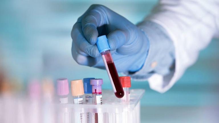 Τα πρώτα τεστ αίματος και ούρων για διάγνωση του αυτισμού 
