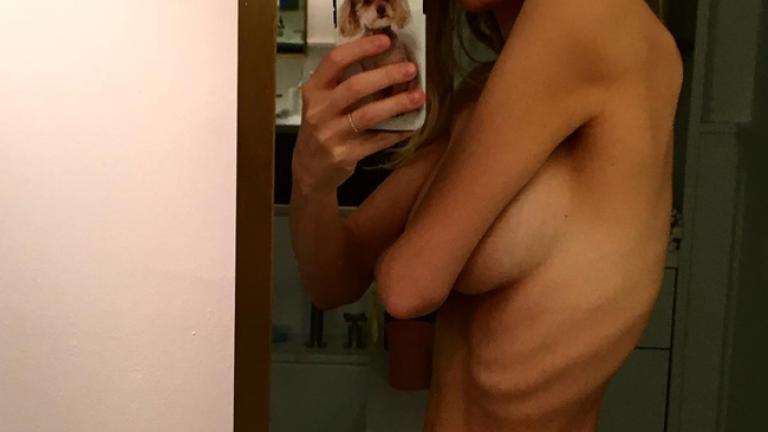 Γνωστή ηθοποιός σοκάρει με την εικόνα της! 