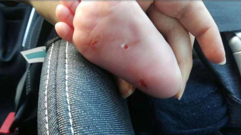 Τρόμος από τη μυστηριώδη γυναίκα που χαρακώνει βρέφη