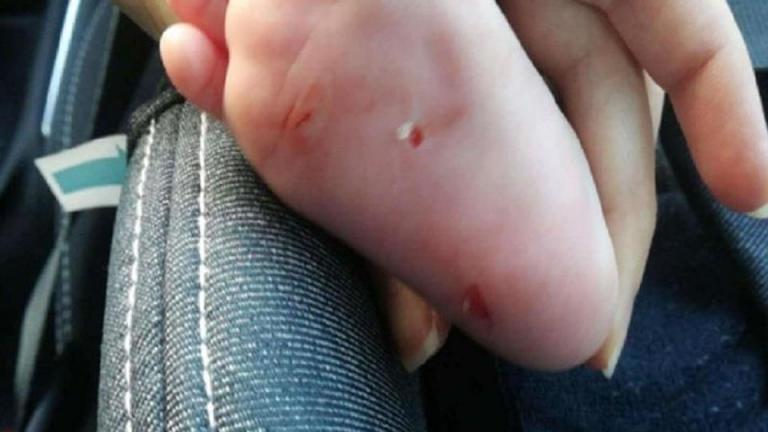 Στον εισαγγελέα οδηγείται η 55χρονη που φέρεται να χαράκωσε μωρά στο πόδι σε εμπορικό κέντρο των νοτίων προαστίων 