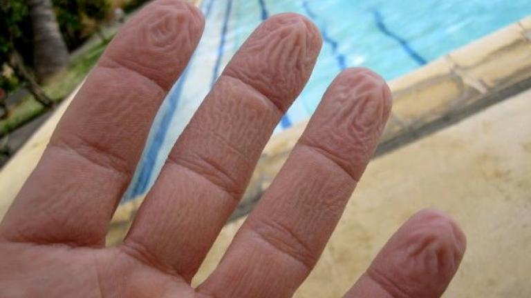 Γιατί ζαρώνουν τα δάχτυλά σας μέσα στο νερό – Όχι, δεν είναι επειδή «μούλιασαν»…