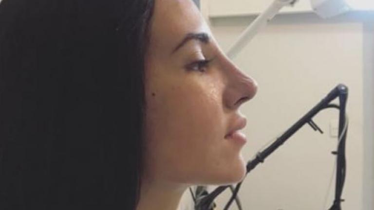 Τζούλια Καραγιάννη: Έβγαλε τις γάζες και μας έδειξε τη νέα της μύτη 