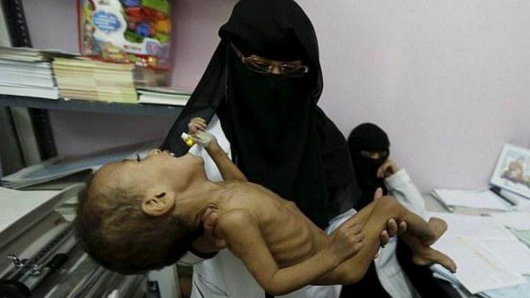 Υεμένη: Ο τερματισμός του πολέμου δεν αρκεί για να σωθούν τα παιδιά, προειδοποιεί η Unicef, ενώ η κυβέρνηση της χώρας δηλώνει έτοιμη για διαπραγματεύσεις 