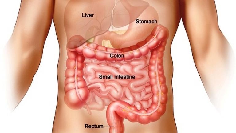 Αυτή η τροφή μειώνει τον κίνδυνο για τον καρκίνο του εντέρου