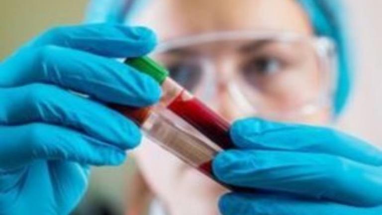 Εξέταση αίματος εντοπίζει τον καρκίνο των ωοθηκών έως και δύο χρόνια νωρίτερα