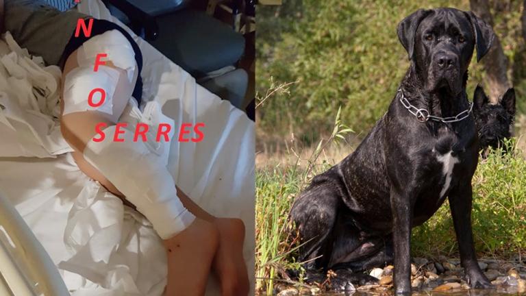 Σκυλιά επιτέθηκαν σε 9χρονο - Νοσηλεύεται στο νοσοκομείο - Τον έσωσε η μητέρα του  (ΦΩΤΟ)