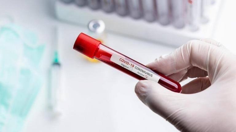 Τα 4 ελπιδοφόρα φάρμακα κατά του κορονοϊού - Περίπου 70 φάρμακα ίσως έχουν κάποιο αποτέλεσμα