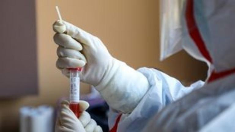 Κοροναϊός: Το εμβόλιο που αναπτύσσεται από το πανεπιστήμιο της Οξφόρδης και την AstraZeneca θα προσφέρει διπλή προστασία