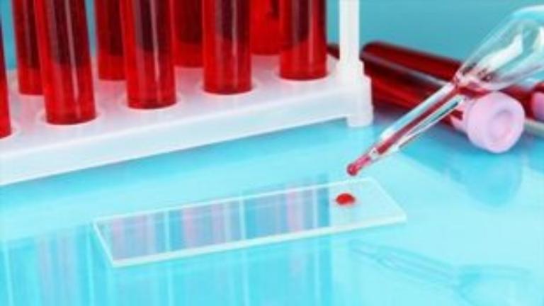 Η AstraZeneca αρχίζει δοκιμές θεραπείας αντισωμάτων της Covid-19