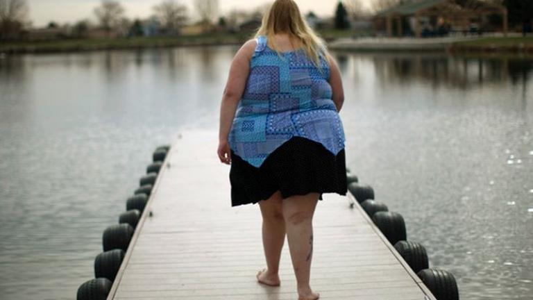 Το 1/3 του πληθυσμού το 2030 θα έχει χαρακτηριστικό παχύσαρκου