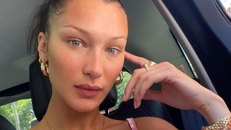 Σε άλλη φωτογραφία η Μπέλα Χαντίντ έδειξε το πόδι της, το οποίο έχει μια τεράστια μελανιά, ενώ στη τρίτη φωτογραφία έδειξε στους ακολούθους της μια σύριγγα γεμάτη με αίμα.  Αξίζει να σημειωθεί πως μέχρι στιγμής δεν έχει γίνει γνωστός ο λόγος για τον οποίο το μοντέλο βρέθηκε στο νοσοκομείο και η ίδια δεν έχει κάνει καμία δήλωση σε εκπρόσωπους των ξένων μέσων ενημέρωσης που έχουν επικοινωνήσει μαζί της.