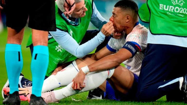 Euro 2024: Πλήγμα με Κιλιάν Εμπαπέ - Χάνει το ματς με Ολλανδία - Με μάσκα στη διοργάνωση