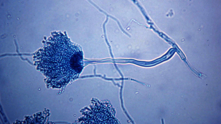 Μύκητας που μπορεί να μας «φάει από μέσα προς τα έξω» ίσως να εξαπλωθεί στον πλανήτη λόγω της κλιματικής αλλαγής