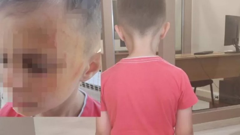 Αγρίνιο: 5χρονος έπεσε θύμα βίας από συμμαθητές του στο νηπιαγωγείο!