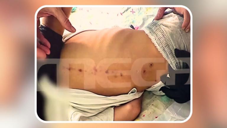 αμεα 10χρονος