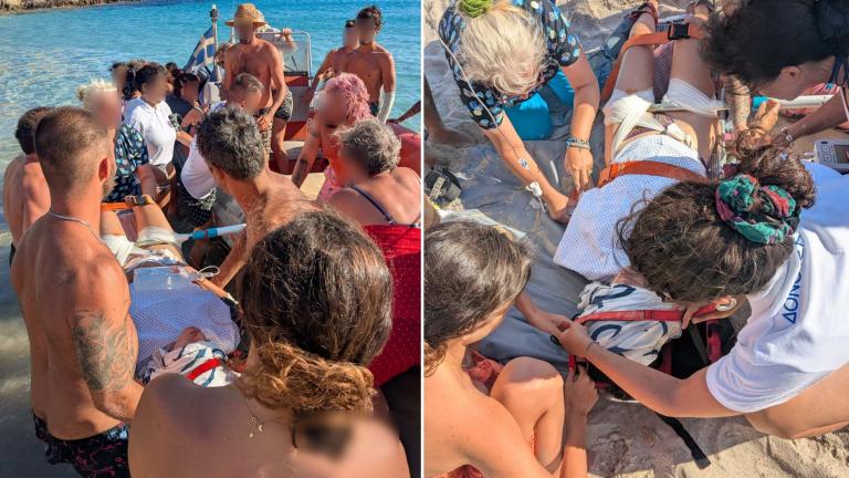 Δονούσα: Ομπρέλα θαλάσσης παρασύρθηκε από τον αέρα και καρφώθηκε στο πόδι τουρίστριας - Μεταφέρθηκε στην Αθήνα