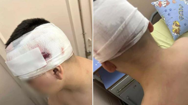 Θεσσαλονίκη: Άγριος ξυλοδαρμός 13χρονου στις Συκιές - Για απόπειρα ανθρωποκτονίας διώκεται ο 18χρονος