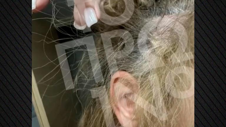 ξυλοδαρμος