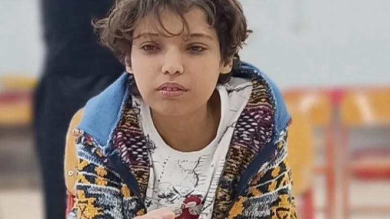 Τορίνο: Συνεχής βελτίωση του 18χρονου Μάριου που υποβλήθηκε σε μεταμόσχευση ήπατος 