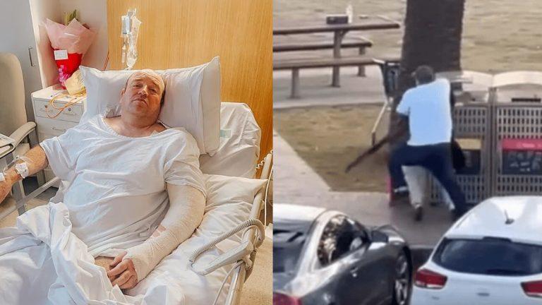 Σίδνεϊ: Δίνει μάχη να μη χάσει το χέρι του ο 43χρονος που ακινητοποίησε τον δράστη του μακελειού