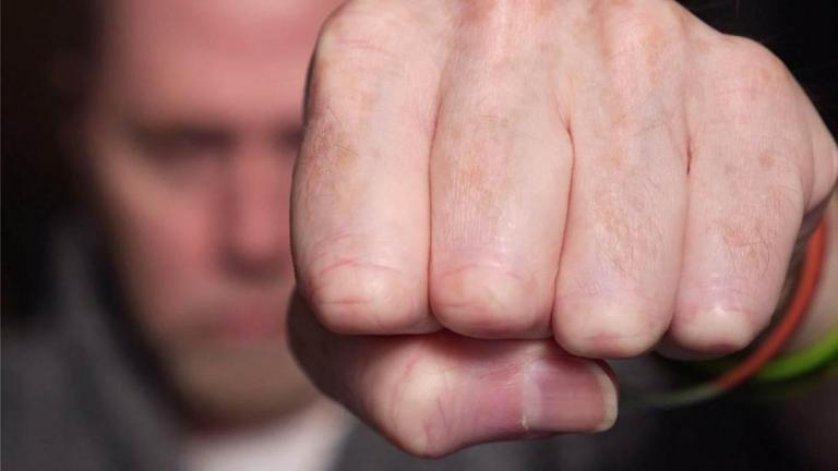 ξυλοδαρμος