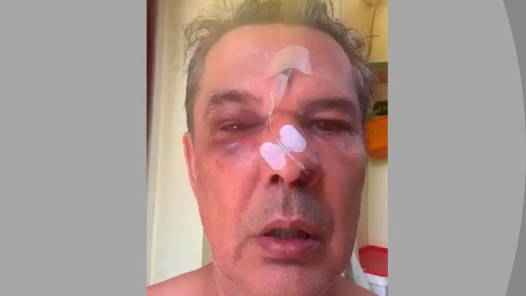 Χαϊδάρι: Άγριος ξυλοδαρμός σε ιατρείο για μια παρατήρηση – «Με περίμενε στις σκάλες και μου ξαναεπιτέθηκε», περιγράφει το θύμα