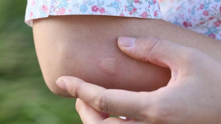 ΚΕΕΛΠΝΟ: Τρεις νεκροί από τον ιό του Δυτικού Νείλου - Ένας στην εντατική