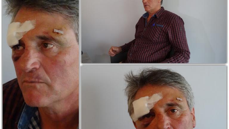 Επιχειρηματίας των Ιωαννίνων καταγγέλλει άγριο ξυλοδαρμό από αστυνομικούς (ΦΩΤΟ+ΒΙΝΤΕΟ)