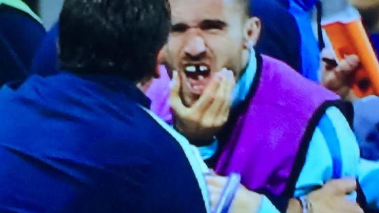 Εικόνες ντροπής από τους Βόσνιους μετά το τέλος του αγώνα με την Εθνική-Έσπασαν το δόντι του Γιαννιώτα (ΦΩΤΟ)