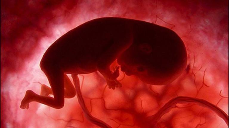 Προσοχή: Κοινό φάρμακο αυξάνει τον κίνδυνο γέννησης μωρών με σοβαρές συγγενείς ανωμαλίες