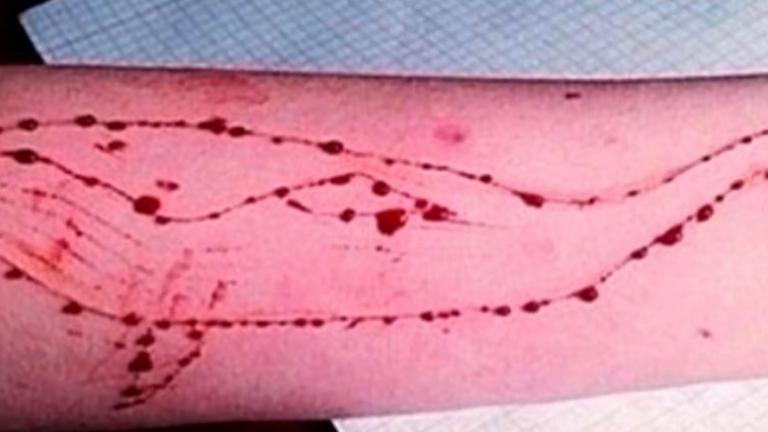 Μαθητής περιγράφει πώς τον «ψάρεψαν» στο fb για να παίξει «μπλε φάλαινα»