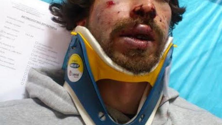 Προθεσμία πήρε ο χρυσαυγίτης για τον τραυματισμό του 24χρονου φοιτητή