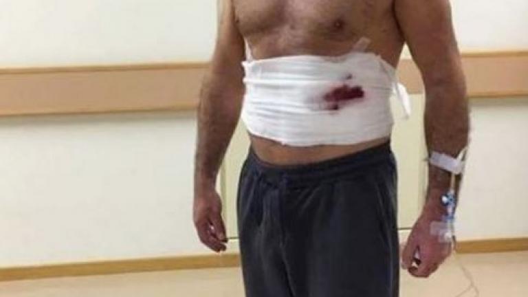 Γνωστός Έλληνας ηθοποιός με αίματα, επίδεσμους και ορό! Τι του συνέβη;
