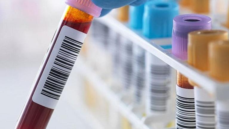 Νέο τεστ αίματος ανιχνεύει τον καρκίνο του οισοφάγου 10 χρόνια πριν από τα συμπτώματα!