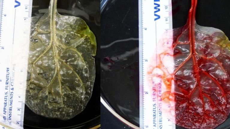 Έφτιαξαν ανθρώπινο ιστό καρδιάς από ένα φύλλο σπανάκι! (ΒΙΝΤΕΟ)