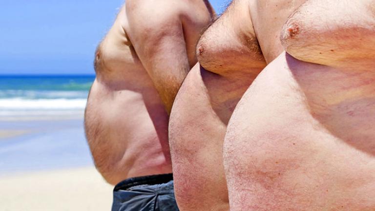 Ένας στους τρεις στον κόσμο είναι υπέρβαροι ή παχύσαρκοι
