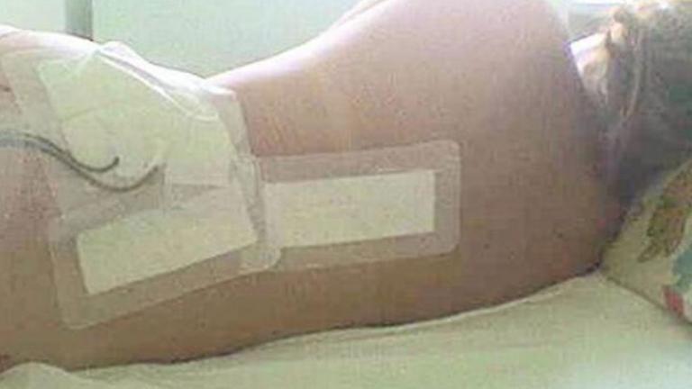 Συγκινητική  εξομολόγηση-Η γυναίκα που νίκησε τη σπάνια μορφή καρκίνου, 8 χρόνια μετά μιλά «έξω από τα δόντια» για την σκληρή εμπειρία της, δίνοντας μαθήματα ζωής